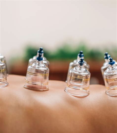 Best Hijama Or Cupping Therapy In Dubai Uae Wellth Clinic