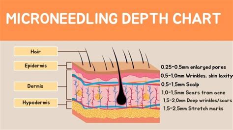 Microneedling Depth Chart Https Microneedlingbeforeafter