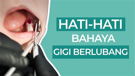 INILAH B4H4YA GIGI BERLUB4NG YANG DIBIARKAN TERLALU LAMA TANPA DITAMBAL