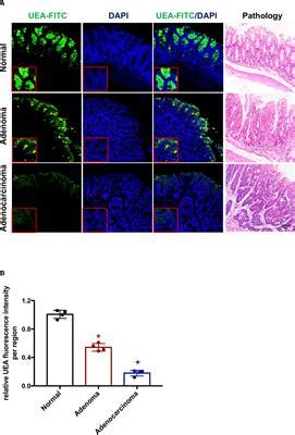 Frontiers Molecular Imaging Of Ulex Europaeus Agglutinin In