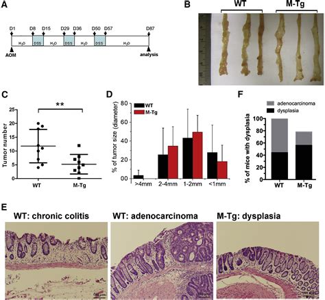 Mir 26a Attenuates Colitis And Colitis Associated Cancer By Targeting