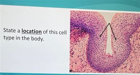 Solved State a location of this cell type in the body. | Chegg.com