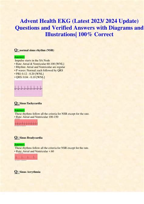 Advent Health EKG (Latest 2023/ 2024 Update) Questions and Verified