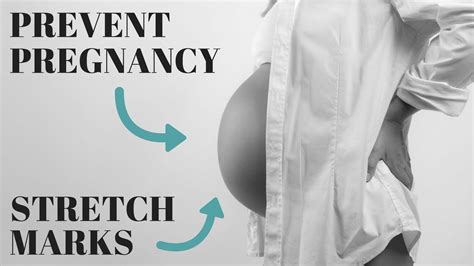 How To Prevent Stretch Marks During Pregnancy 7 Most Effective Methods Youtube