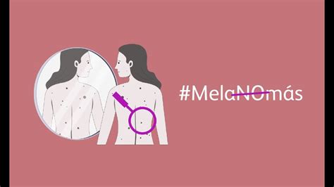 Campaña Melanomás Día Mundial Del Melanoma 2023 Youtube