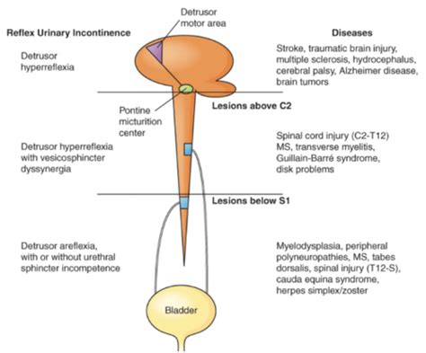 Lecture Alterations Of Renal And Urinary Tract Function Urinary