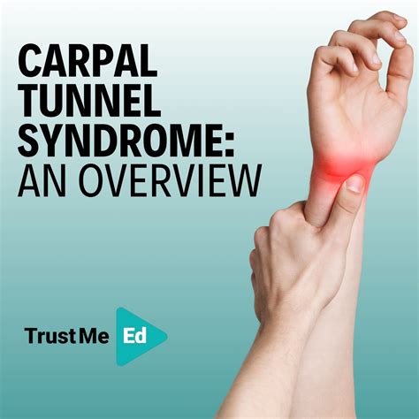CARPAL TUNNEL SYNDROME: AN OVERVIEW