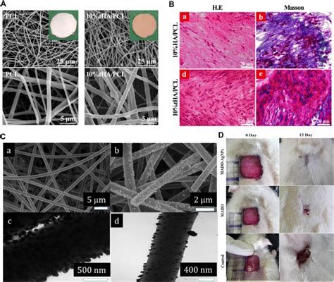 Current Progress In Application Of Polymeric Nanofibers To Tissue Engineering Nano Convergence