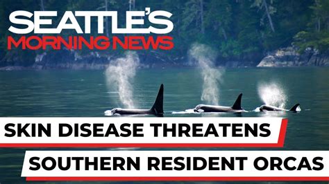 Skin Disease Threatens Puget Sound S Endangered Southern Resident Orcas