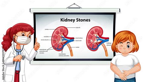 Kidney stones symptoms cartoon style infographic with doctor cartoon ...