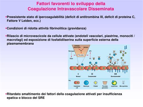 PPT La Coagulazione Intravascolare Disseminata CID Eziologia E