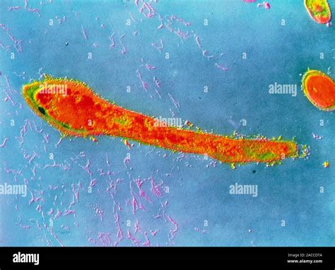 False Colour Transmission Electron Micrograph TEM Showing A Single