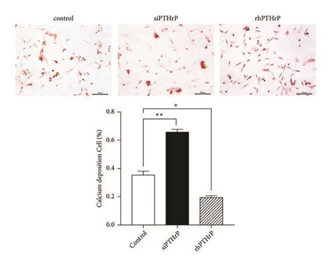 Effect Of Pthrp On Chondrocyte Proliferation And Differentiation Oa