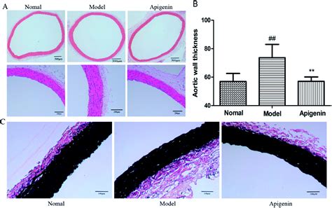 Apigenin Ameliorates Vascular Injury In Rats With High Fructose Induced