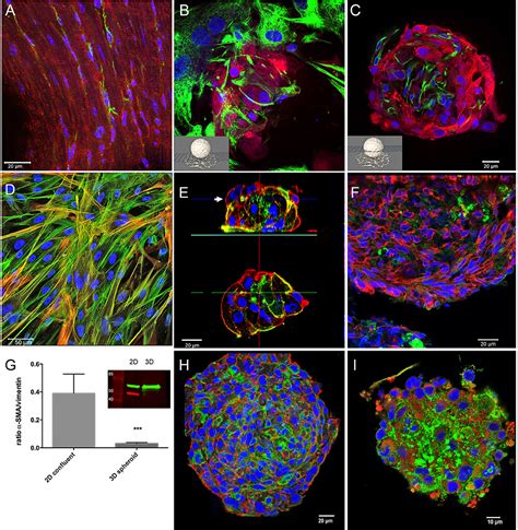 Frontiers 3D Co Culture Of HiPSC Derived Cardiomyocytes With Cardiac