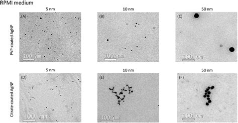 Characterization By TEM Of PVP And Citrate Coated AgNP 5 10 And