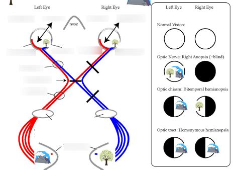 optic chiasm diagram quizlet