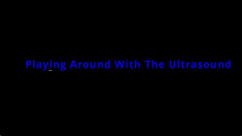 Ultrasound Videos Xvideos