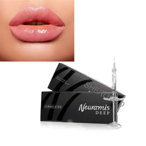 Neuramis Cross Linked Facial Hyaluronic Acid Dermal Filler China