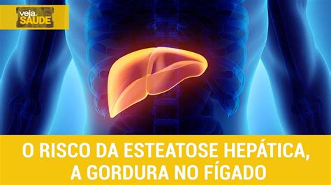 Veja Saúde o risco da esteatose hepática a gordura no fígado YouTube