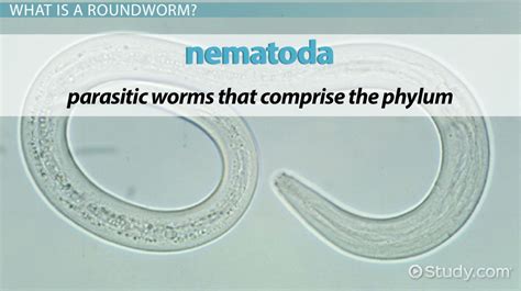 What Are Roundworms Types Examples And Characteristics Video And Lesson Transcript