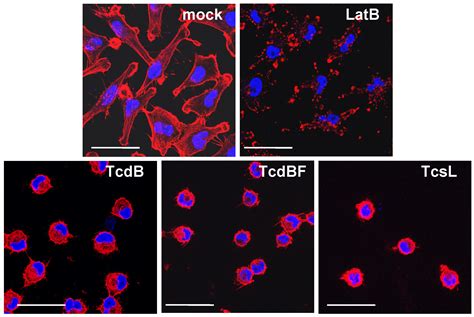 Toxins Free Full Text Difference In F Actin Depolymerization