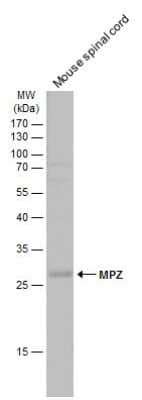 Myelin Protein Zero Antibody (NBP3-13353): Novus Biologicals