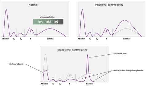 Plasma Cell Tumours In Dogs Multiple Myeloma Veterinary Practice