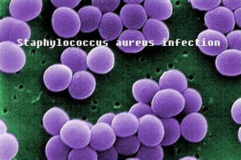 Staphylococcus aureus infection causes and prevention