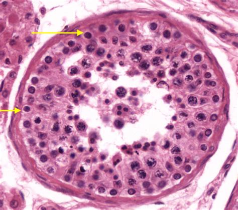 Spermatogenesis Histology