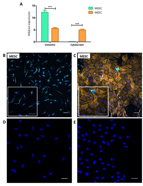 Immunostaining And Quantitative Rt Pcr For Vimentin And Cytokeratin In Download Scientific