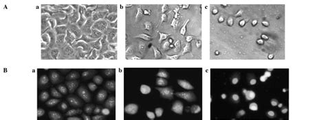 Morphological Changes In SGC 7901 Cells Treated With CG The Cells Were