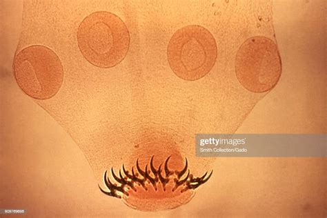 Tapeworm Scolex Four Suckers Morphology Revealed In A Micrograph Nachrichtenfoto Getty Images