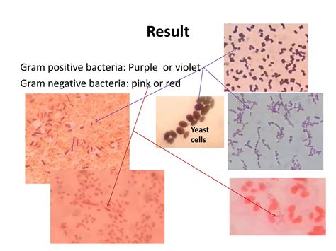 Bacterial staining methods | PPT