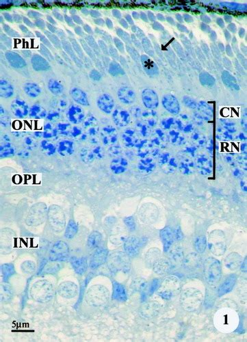 Giant Mitochondria In The Retina Cone Inner Segments Of Shrews Of Genus Sorex Insectivora