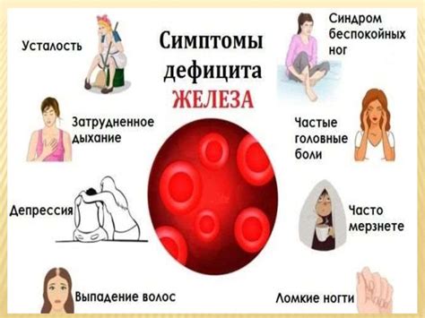 Железодефицитная анемия - online presentation