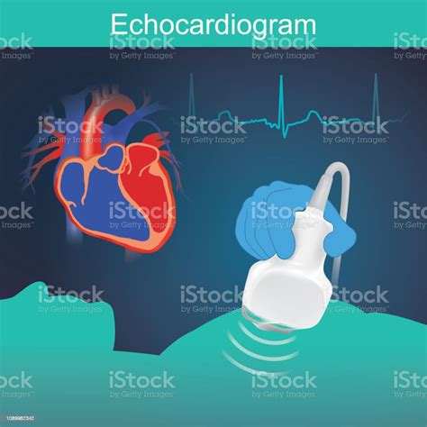 Echokardiogramm Stock Vektor Art Und Mehr Bilder Von Ultraschall