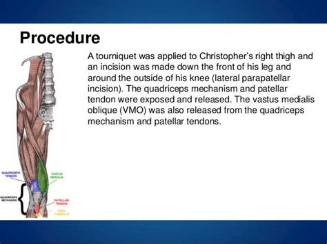 Christopher: Knee Pain, Severe Crouch Gait, & Hip Flexion Contracture…