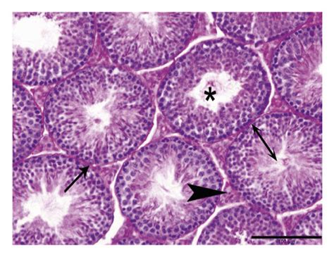 Photomicrograph Of Mices Testis Bar 100 μm Stain Hpas A D