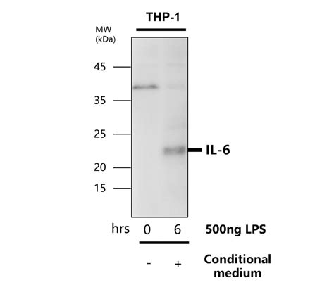 Inflammation Antibody Panel Irap Ireal Biotechnology Inc