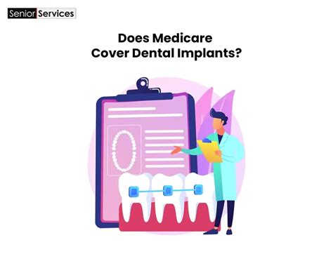 Medicare Dental Coverage A Guide For Seniors