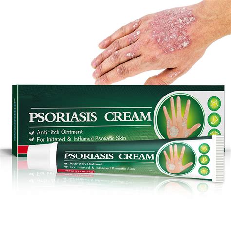 Psoriasis Cream Anti Itch Control Face And Body Cream Herbal Tinea