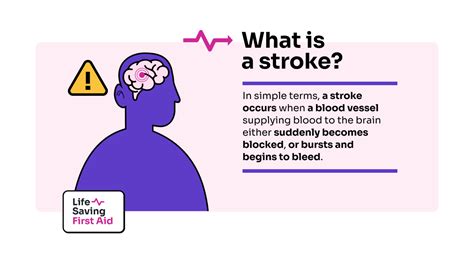 02 Stroke Blog Post Life Saving First Aid