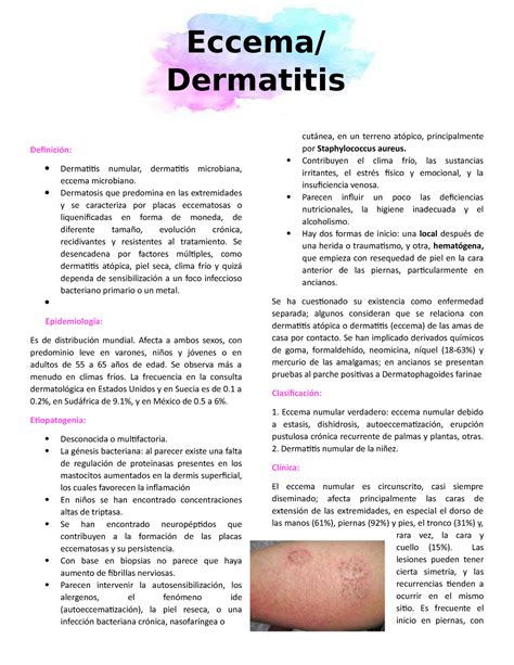 Dermatitis De Numular Un Apunte De Este Tema Espero Que Te Sirva