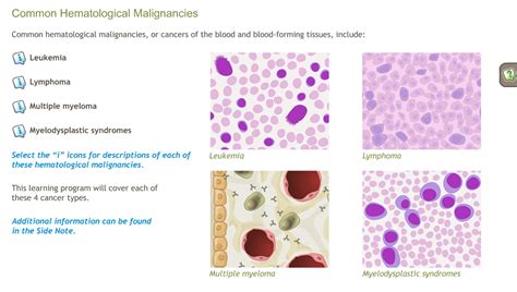 Understanding Common Hematological Malignancies-A.D.A.M. OnDemand