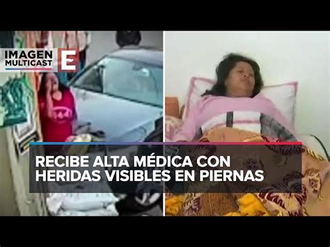 Joven Se Lesiona Al Caer De Las Escalinatas De Tlaxcala Tras