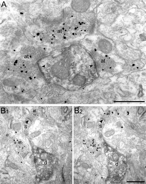 Nk1 Immunopositive Neurons In The Lateral Nucleus Of The Amygdala Are