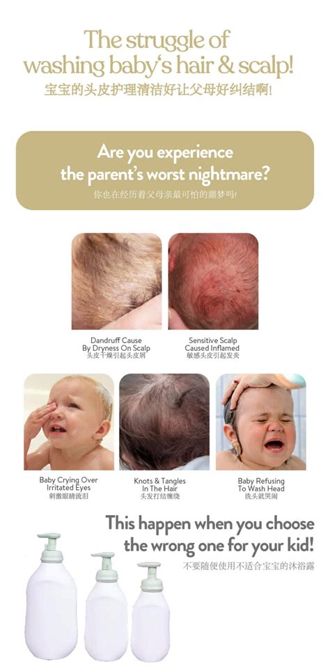 Babe Laboratorios Pediatric Extra Mild Shampoo Ml Does Not Sting Baby Eyes Winsome Baby