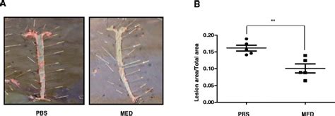 Med Effectively Reduces Atherosclerotic Lesions In Hfd Fed Apoe