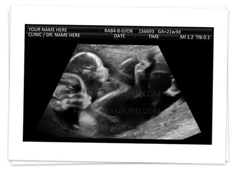 30 40 Weeks Twins 2d Ultrasound Fake Ultrasound